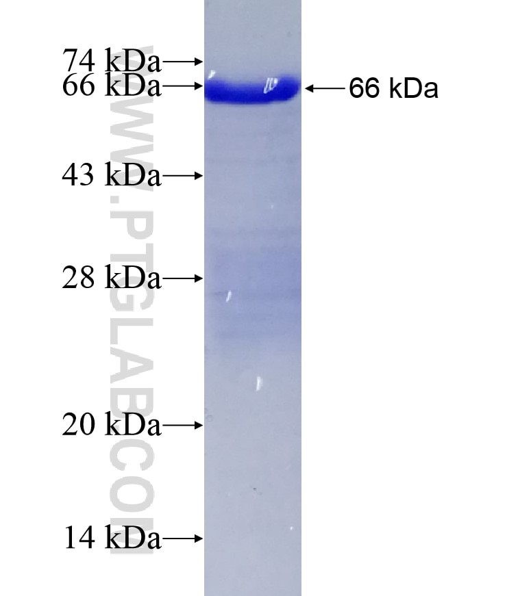 TDRD3 fusion protein Ag4174 SDS-PAGE