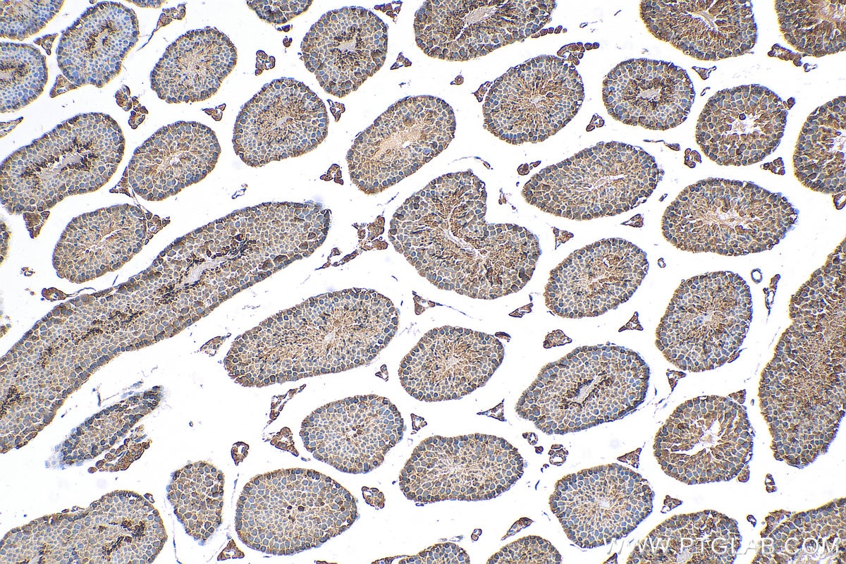 Immunohistochemistry (IHC) staining of mouse testis tissue using TDRD5 Polyclonal antibody (25239-1-AP)