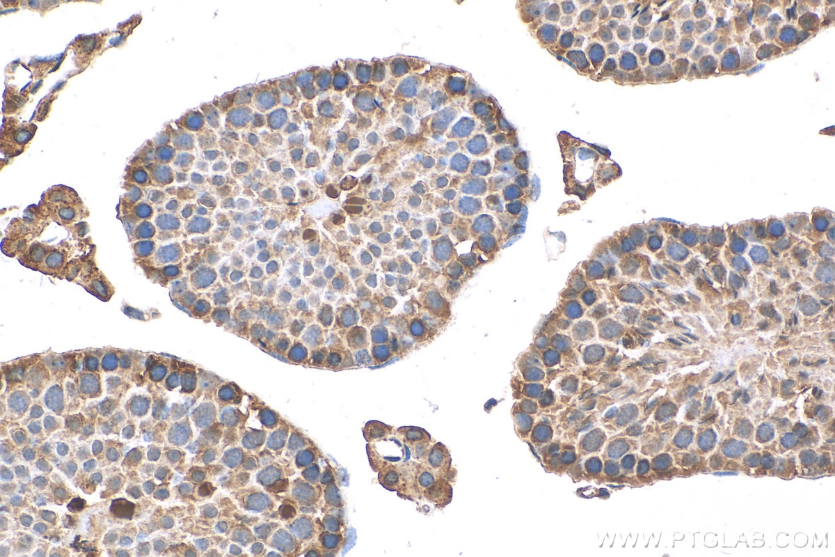 Immunohistochemistry (IHC) staining of mouse testis tissue using TDRD5 Polyclonal antibody (25239-1-AP)