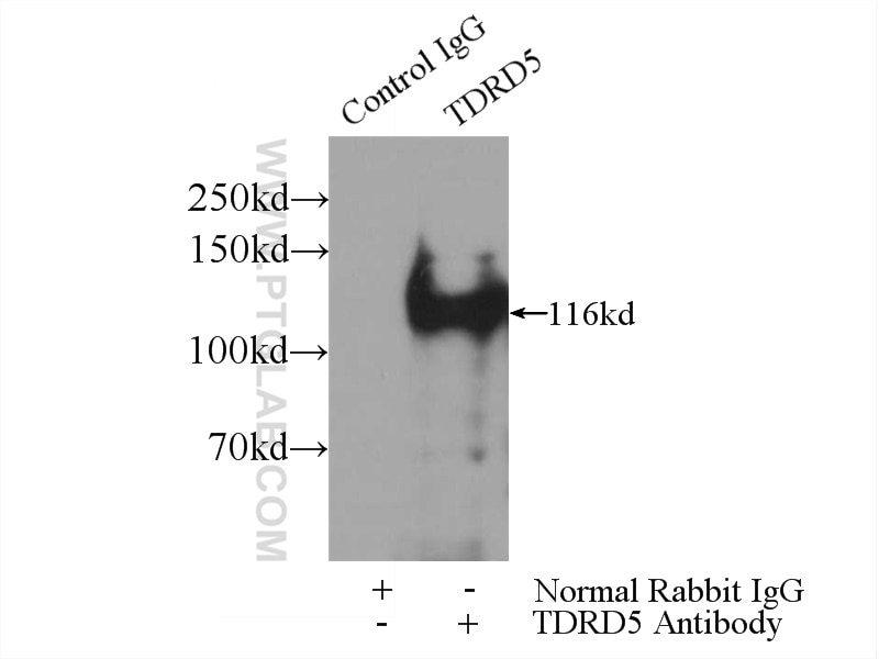 Immunoprecipitation (IP) experiment of mouse testis tissue using TDRD5 Polyclonal antibody (25239-1-AP)