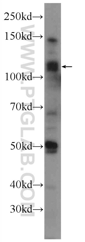 Western Blot (WB) analysis of mouse testis tissue using TDRD5 Polyclonal antibody (25239-1-AP)