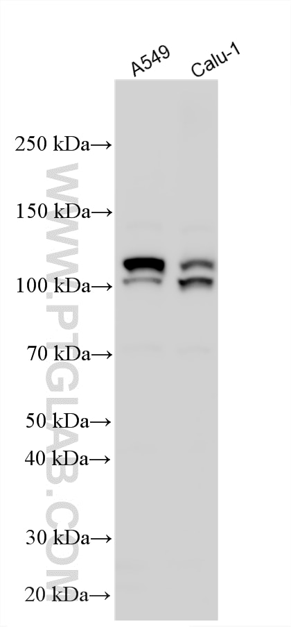 Western Blot (WB) analysis of various lysates using TDRD7 Polyclonal antibody (17102-1-AP)