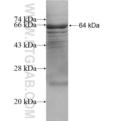TDRD7 fusion protein Ag10773 SDS-PAGE