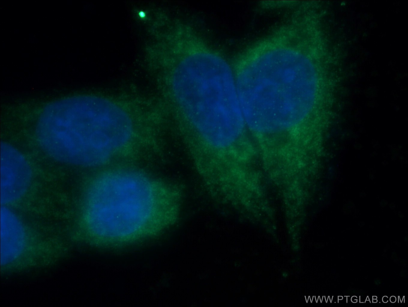 Immunofluorescence (IF) / fluorescent staining of HeLa cells using TDRKH specific Polyclonal antibody (13528-1-AP)