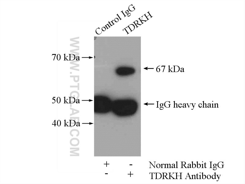 Immunoprecipitation (IP) experiment of mouse brain tissue using TDRKH specific Polyclonal antibody (13528-1-AP)
