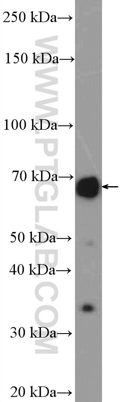 Western Blot (WB) analysis of mouse brain tissue using TDRKH specific Polyclonal antibody (13528-1-AP)