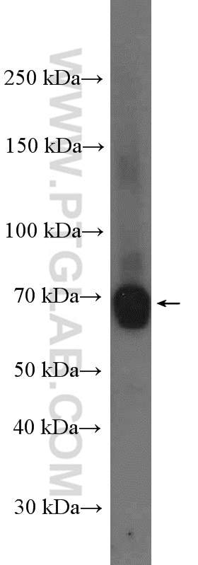 Western Blot (WB) analysis of NCCIT cells using TDRKH specific Polyclonal antibody (13528-1-AP)