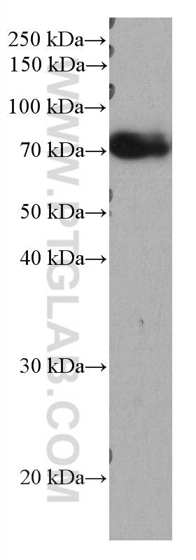 Western Blot (WB) analysis of NCCIT cells using TDRKH Monoclonal antibody (66845-1-Ig)