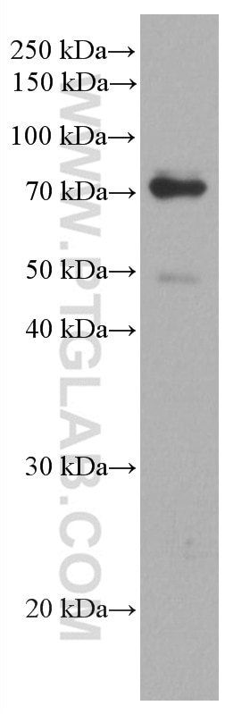 Western Blot (WB) analysis of LNCaP cells using TDRKH Monoclonal antibody (66845-1-Ig)