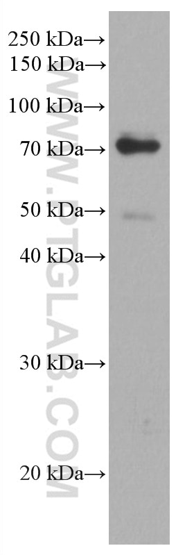 WB analysis of LNCaP using 66845-1-Ig