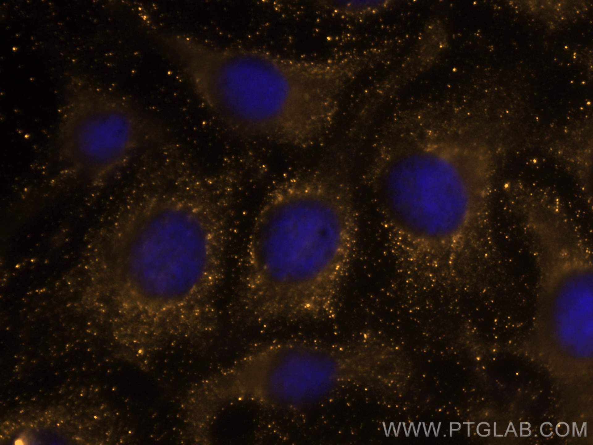Immunofluorescence (IF) / fluorescent staining of U2OS cells using CoraLite®555-conjugated TDRKH Monoclonal antibody (CL555-66845)
