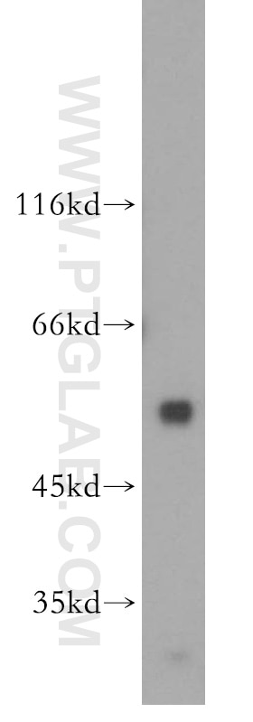 TEAD1 Polyclonal antibody