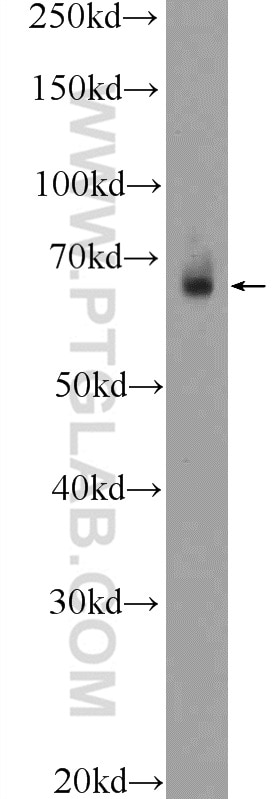 Western Blot (WB) analysis of mouse colon tissue using TEAD2 Polyclonal antibody (21159-1-AP)