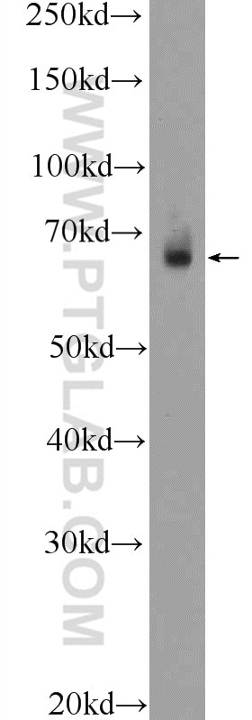 WB analysis of mouse colon using 21159-1-AP