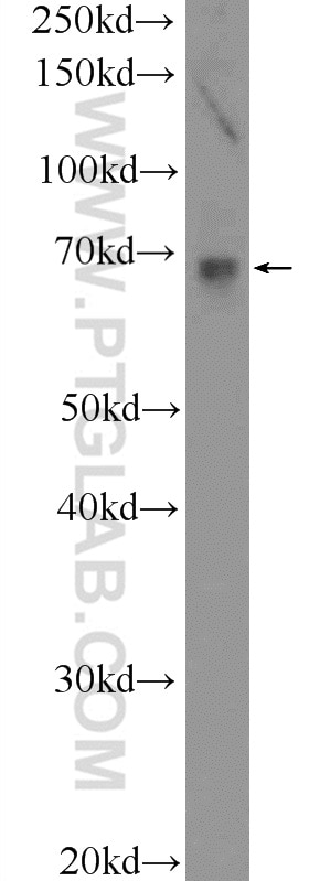 Western Blot (WB) analysis of mouse lung tissue using TEAD2 Polyclonal antibody (21159-1-AP)