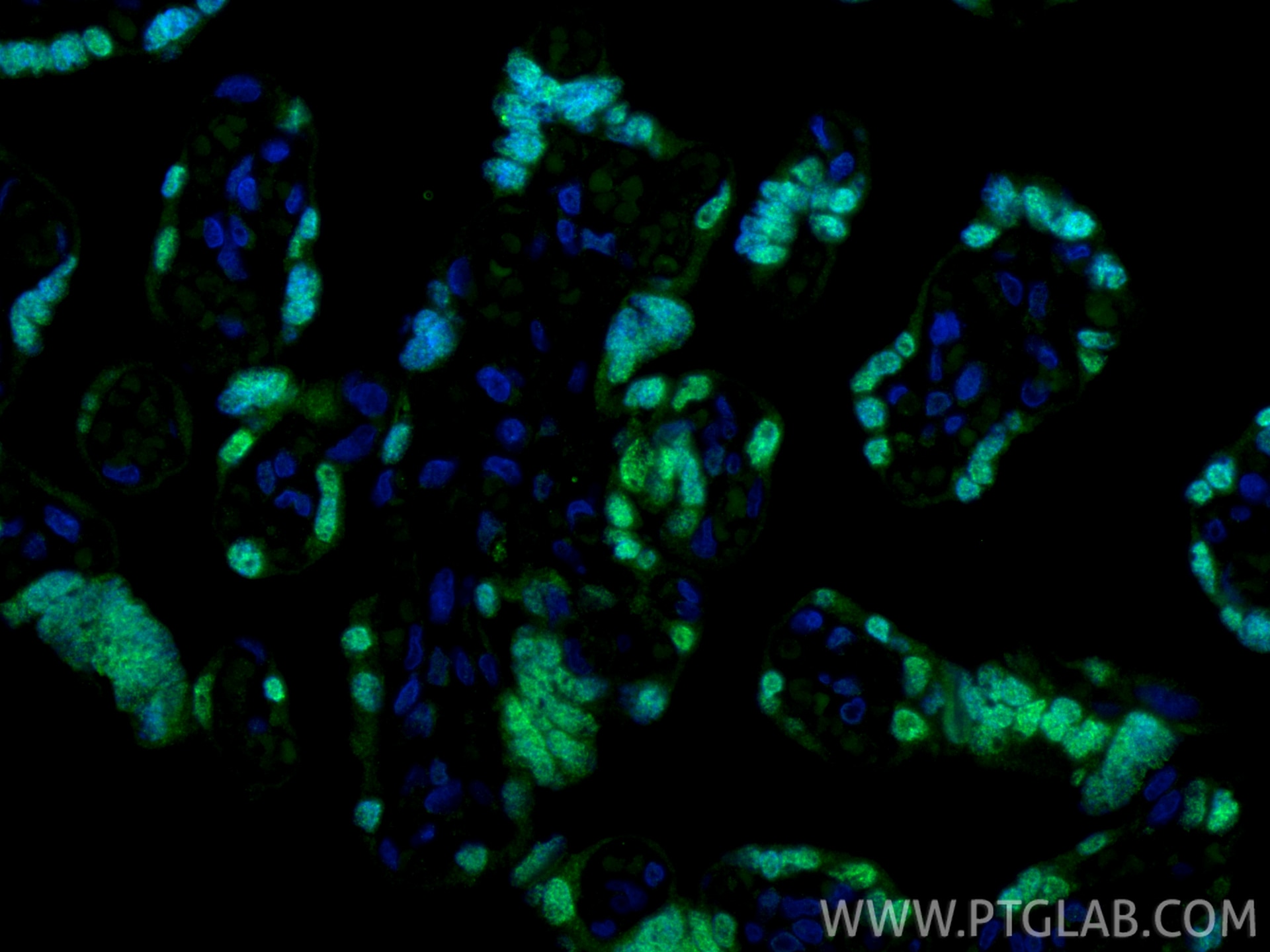 Immunofluorescent analysis of (4% PFA) fixed paraffin-embedded human placenta tissue using TEAD3 antibody (68464-1-Ig, Clone: 2E6A12 ) at dilution of 1:400 and CoraLite®488-Conjugated Goat Anti-Mouse IgG(H+L) (SA00013-1). Heat mediated antigen retrieval with Tris-EDTA buffer (pH 9.0). Immunofluorescence (IF) / fluorescent staining of human placenta tissue using TEAD3 Monoclonal antibody (68464-1-Ig)
