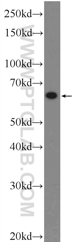 Western Blot (WB) analysis of MCF-7 cells using TEAD4 Polyclonal antibody (12418-1-AP)