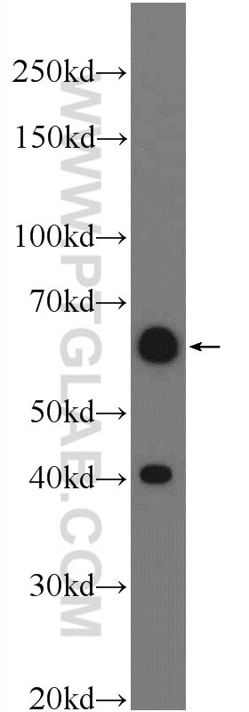 Western Blot (WB) analysis of BGC-823 cells using TEAD4 Polyclonal antibody (12418-1-AP)