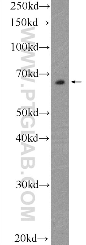 TEAD4 Polyclonal antibody