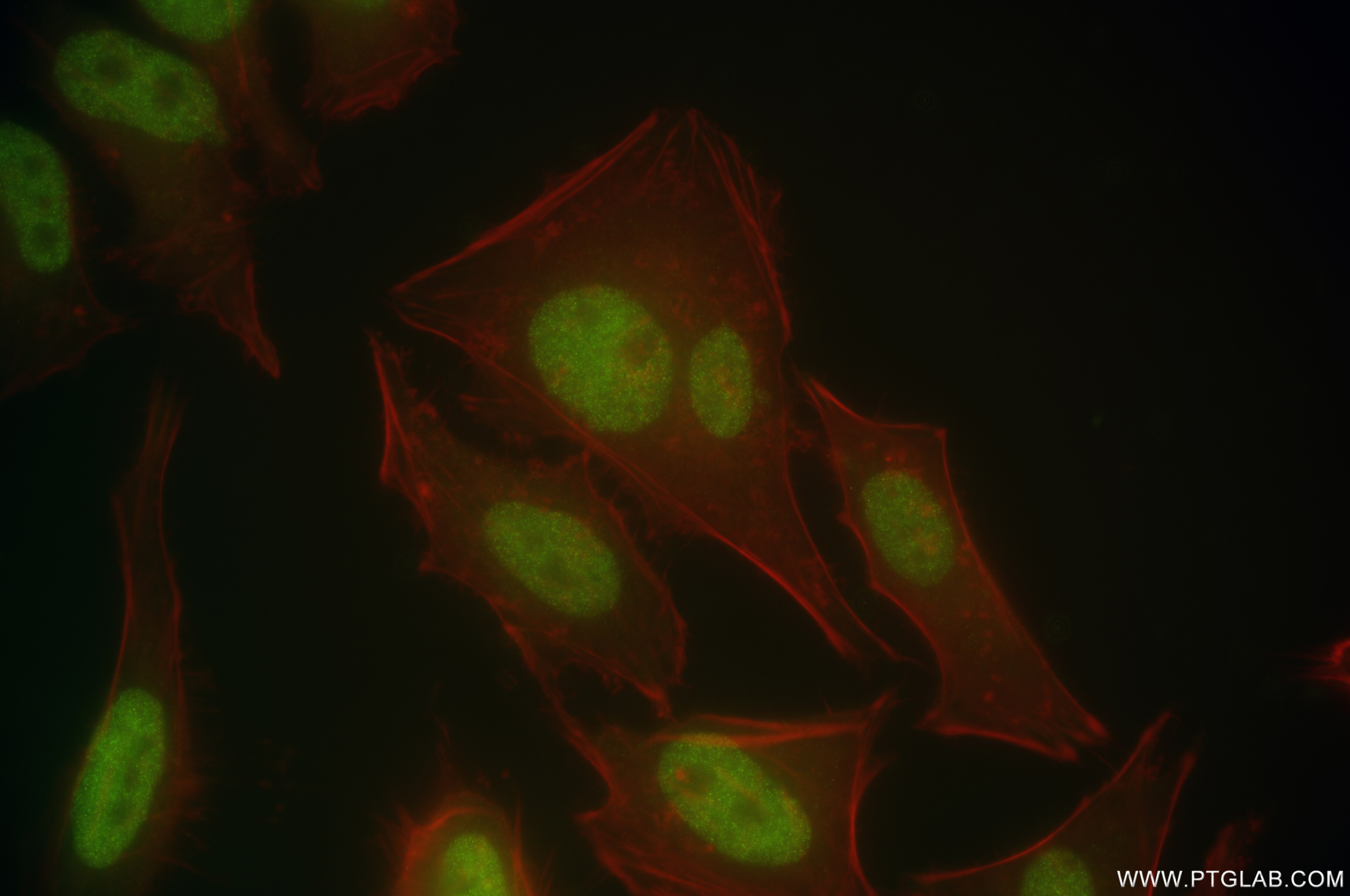 Immunofluorescence (IF) / fluorescent staining of HeLa cells using TEAD4 Recombinant antibody (84932-4-RR)