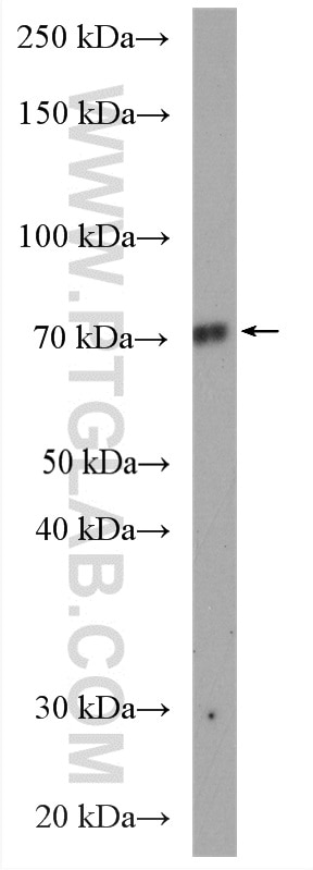 Western Blot (WB) analysis of K-562 cells using TEC Polyclonal antibody (18085-1-AP)