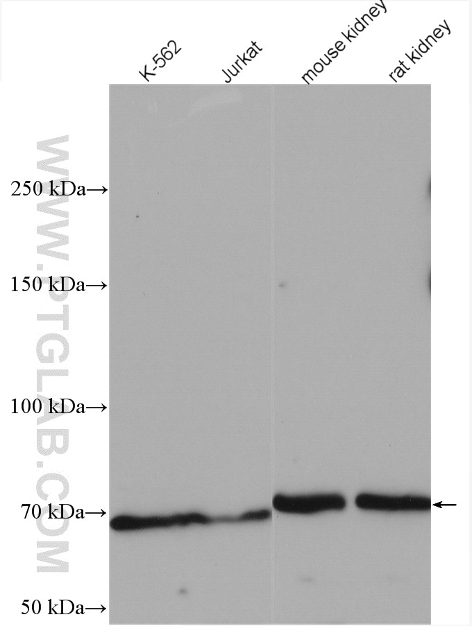 Western Blot (WB) analysis of various lysates using TEC Polyclonal antibody (18085-1-AP)