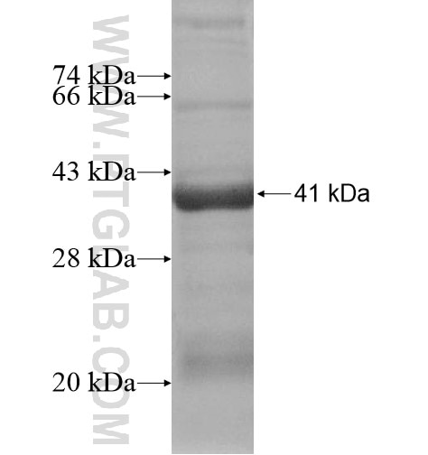 TECPR2 fusion protein Ag15849 SDS-PAGE