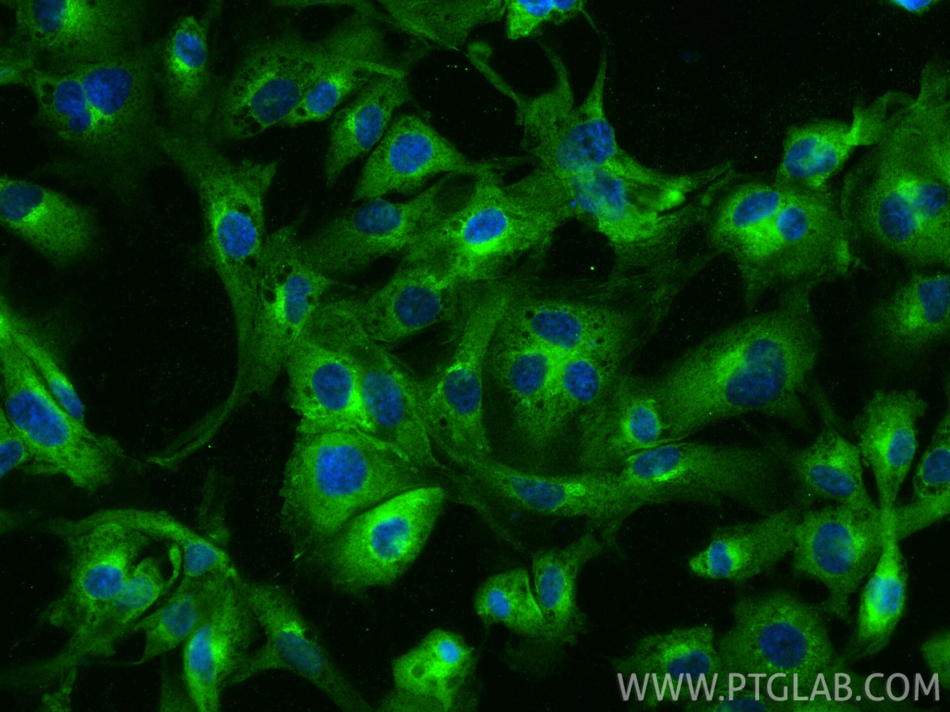 Immunofluorescence (IF) / fluorescent staining of HUVEC cells using Tie-2/CD202b Polyclonal antibody (19157-1-AP)