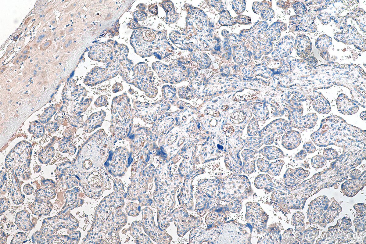 Immunohistochemistry (IHC) staining of human placenta tissue using Tie2 Polyclonal antibody (19157-1-AP)