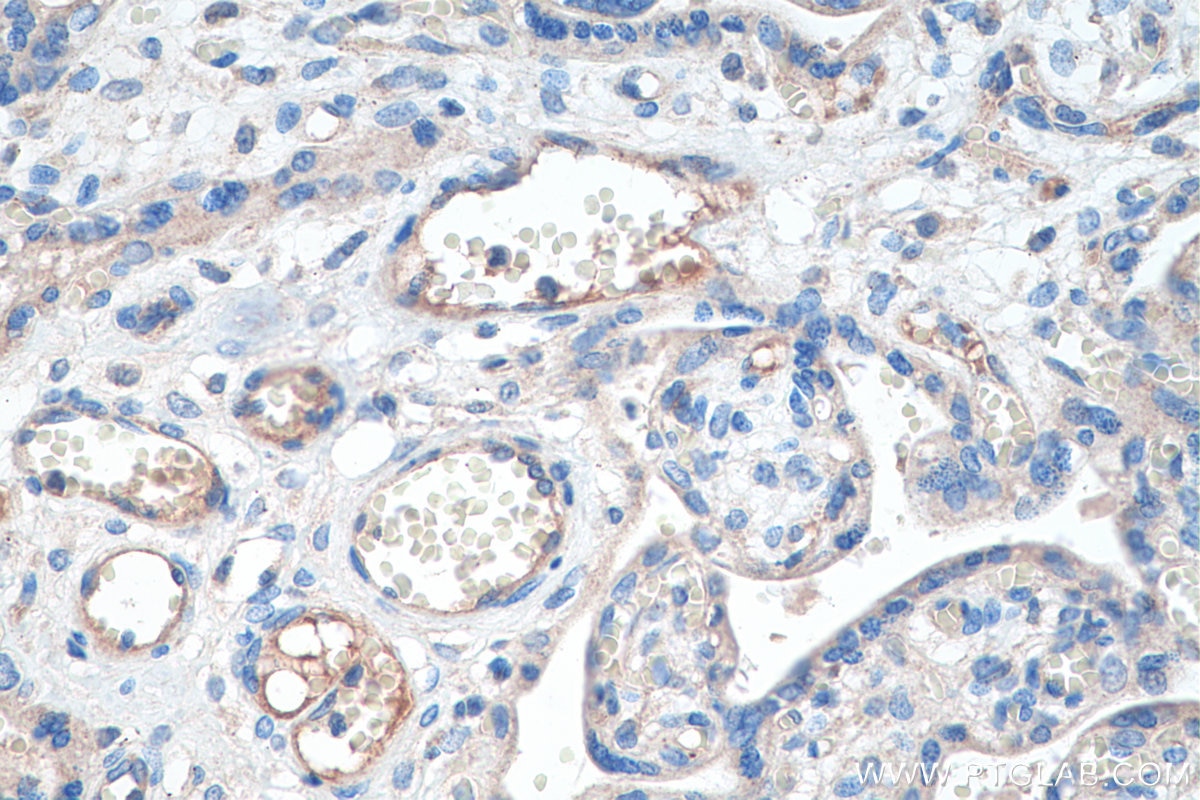 Immunohistochemistry (IHC) staining of human placenta tissue using Tie2 Polyclonal antibody (19157-1-AP)