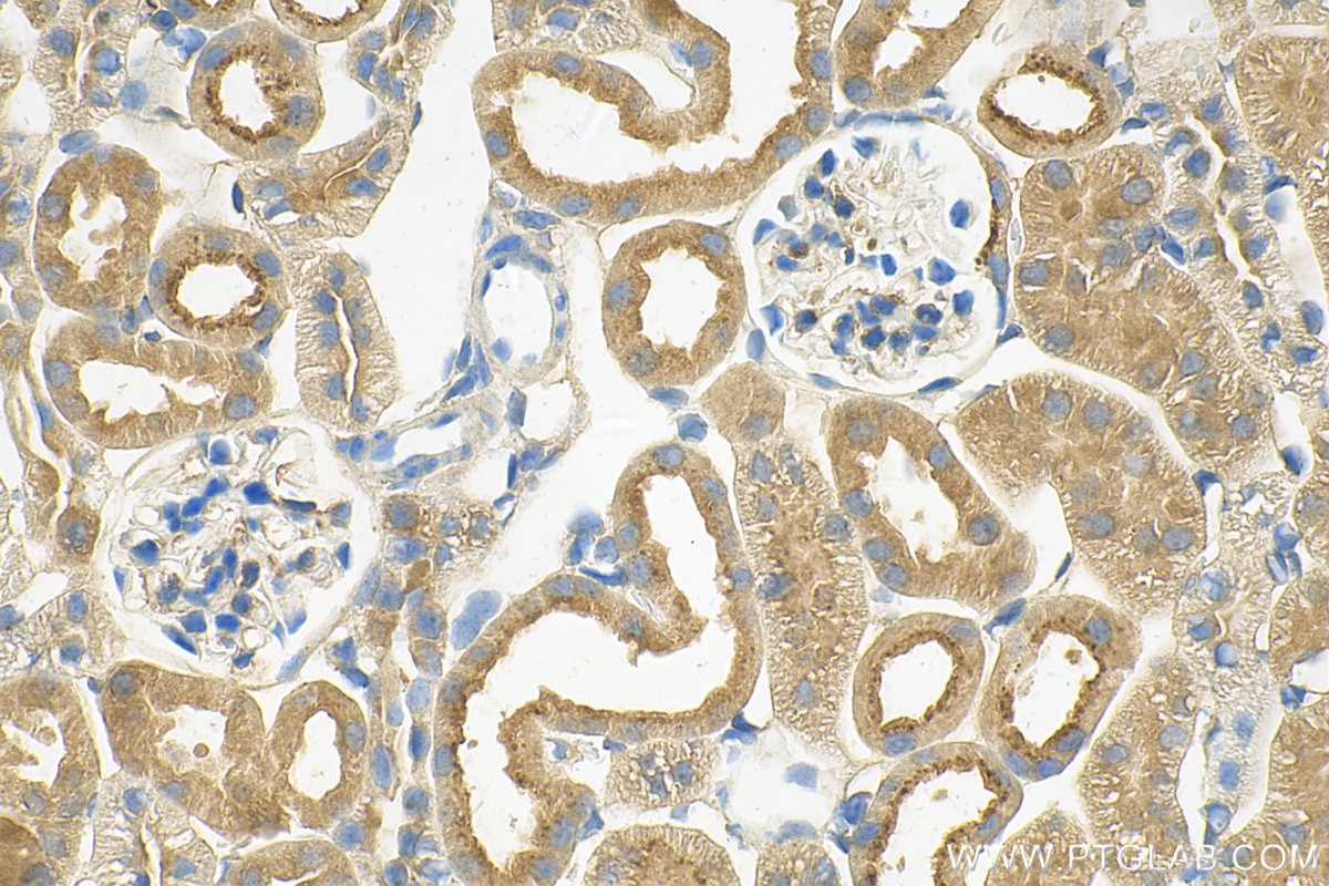 Immunohistochemistry (IHC) staining of mouse kidney tissue using Tie2 Polyclonal antibody (19157-1-AP)