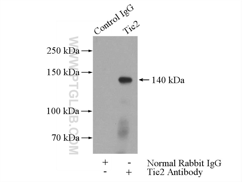 Immunoprecipitation (IP) experiment of mouse lung tissue using Tie2 Polyclonal antibody (19157-1-AP)