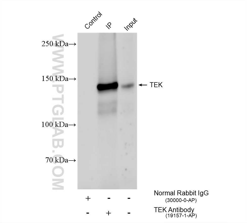 IP result of anti-Tie-2/CD202b (IP:19157-1-AP, 4ug; Detection:19157-1-AP 1:1000) with mouse lung tissue lysate 1240 ug. Immunoprecipitation (IP) experiment of mouse lung tissue using Tie-2/CD202b Polyclonal antibody (19157-1-AP)