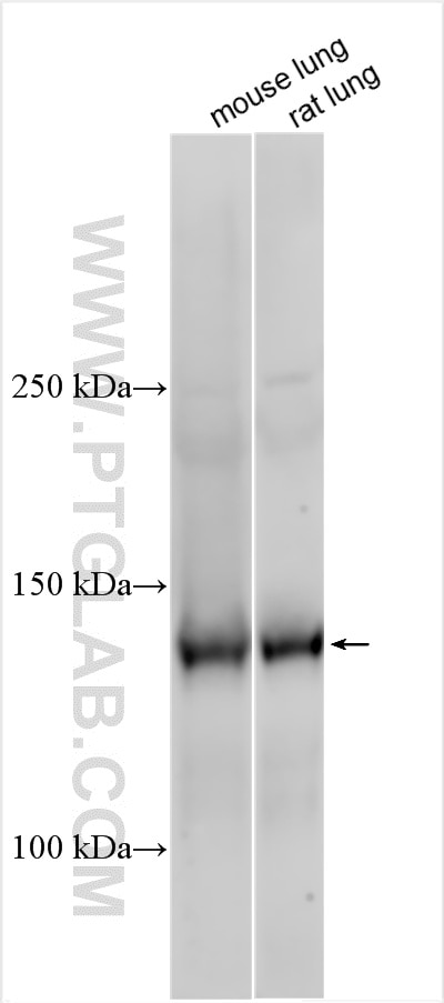 Western Blot (WB) analysis of mouse lung tissue using Tie-2/CD202b Polyclonal antibody (19157-1-AP)