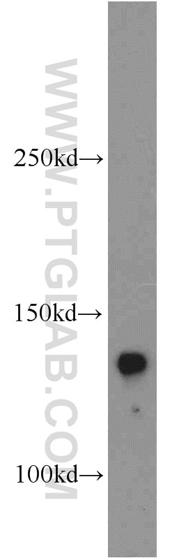 Western Blot (WB) analysis of mouse lung tissue using Tie2 Polyclonal antibody (19157-1-AP)