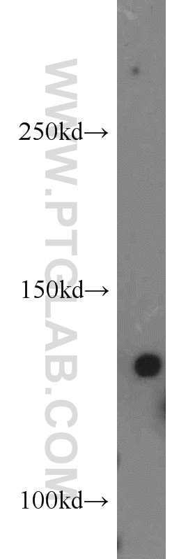 Western Blot (WB) analysis of mouse liver tissue using Tie2 Polyclonal antibody (19157-1-AP)