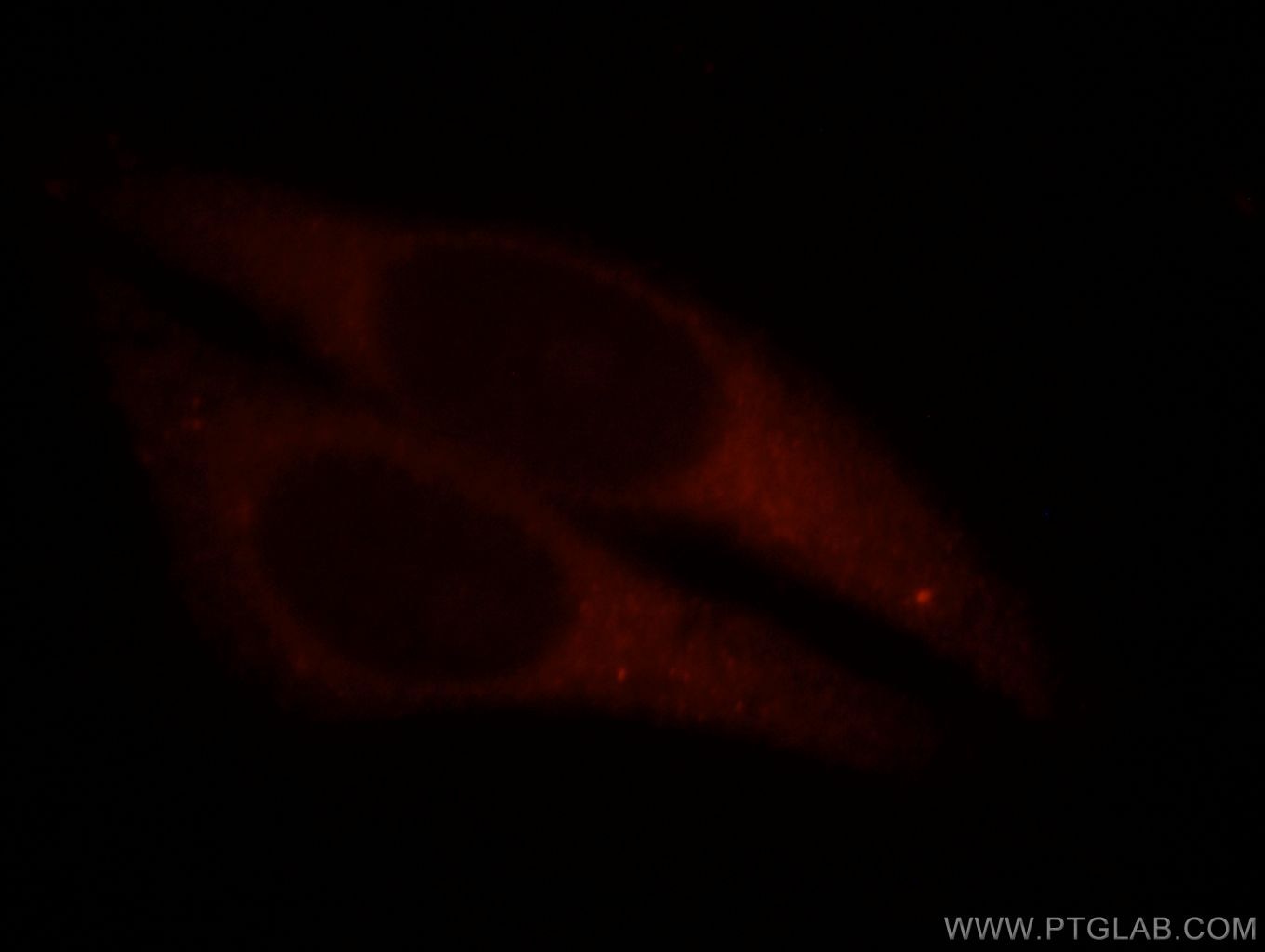 IF Staining of HepG2 using 18968-1-AP