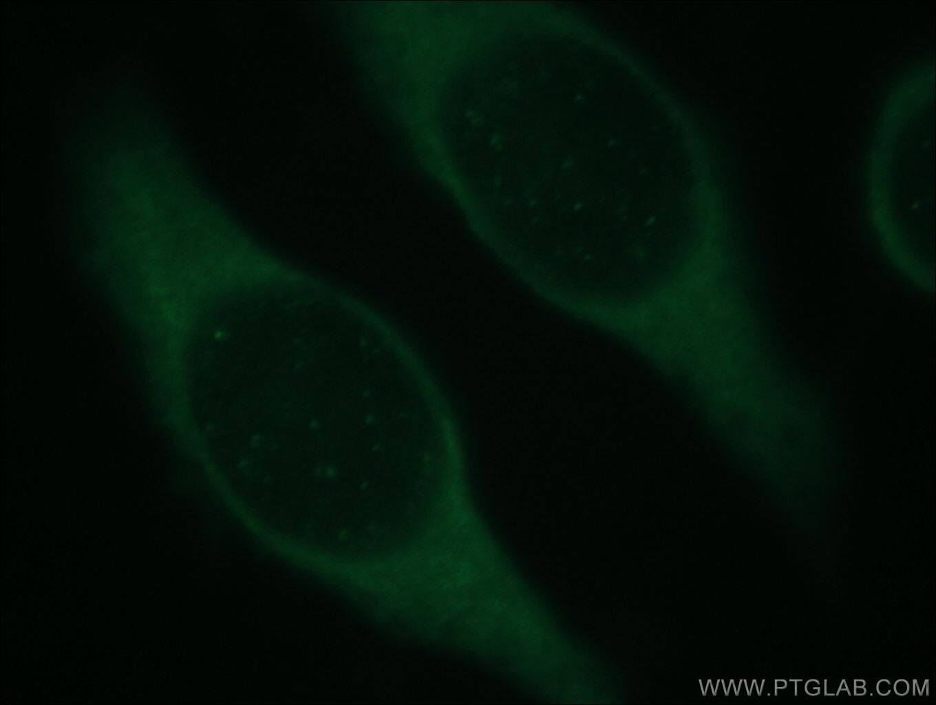 Immunofluorescence (IF) / fluorescent staining of MCF-7 cells using TEKT1 Polyclonal antibody (18968-1-AP)