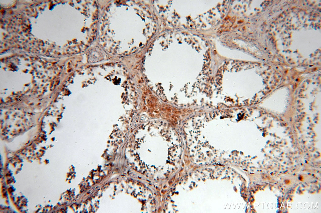 Immunohistochemistry (IHC) staining of human testis tissue using TEKT1 Polyclonal antibody (18968-1-AP)