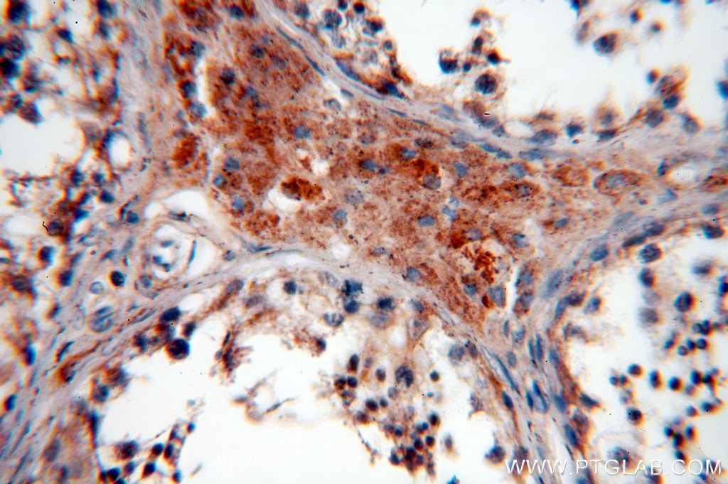 Immunohistochemistry (IHC) staining of human testis tissue using TEKT1 Polyclonal antibody (18968-1-AP)