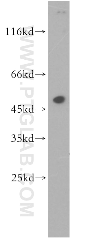 Western Blot (WB) analysis of human brain tissue using TEKT1 Polyclonal antibody (18968-1-AP)