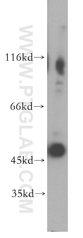 Western Blot (WB) analysis of human testis tissue using TEKT1 Polyclonal antibody (18968-1-AP)