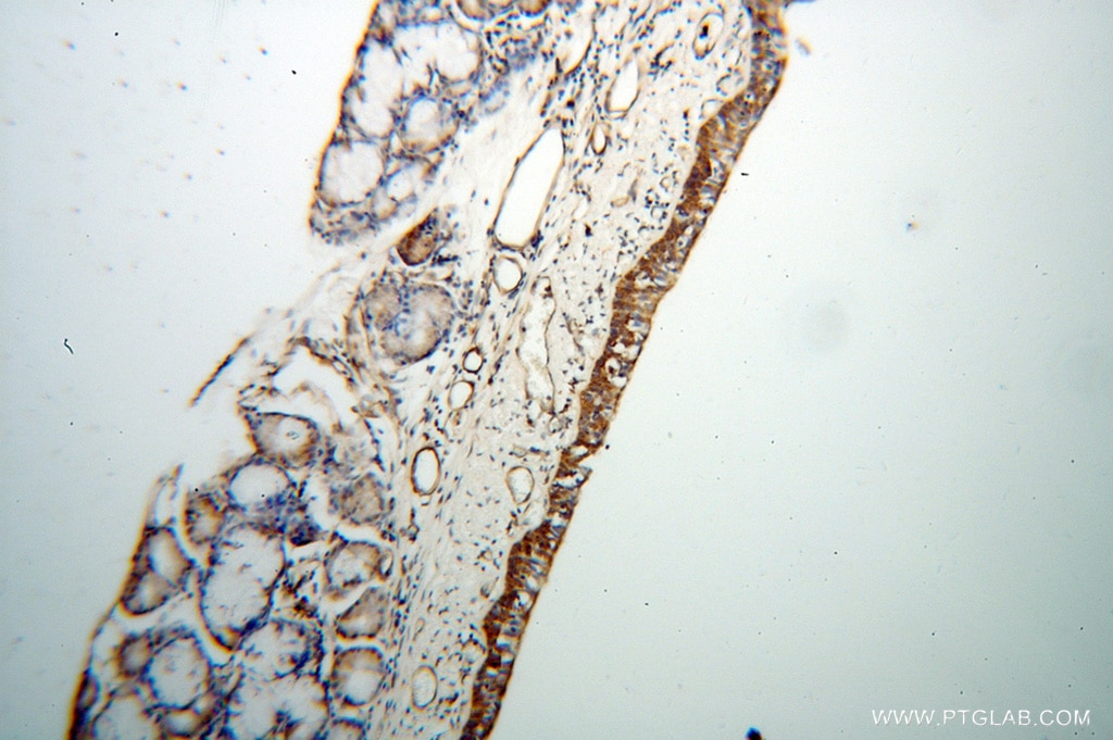 Immunohistochemistry (IHC) staining of human trachea tissue using TEKT2 Polyclonal antibody (13518-1-AP)