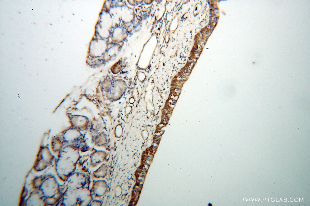 IHC staining of human trachea using 13518-1-AP