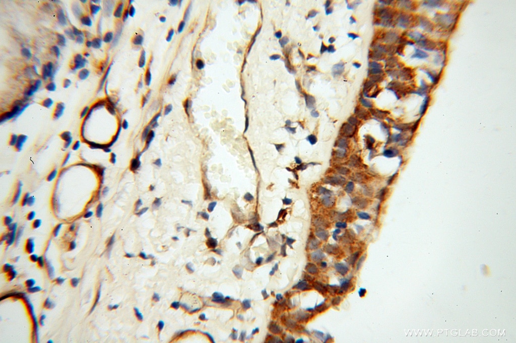 Immunohistochemistry (IHC) staining of human trachea tissue using TEKT2 Polyclonal antibody (13518-1-AP)