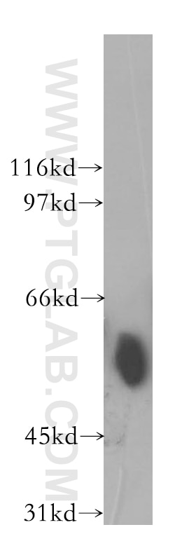 Western Blot (WB) analysis of mouse brain tissue using TEKT2 Polyclonal antibody (13518-1-AP)