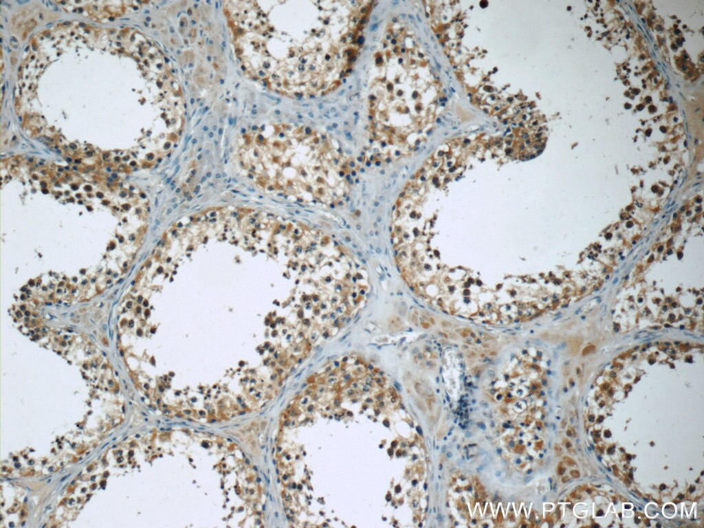 Immunohistochemistry (IHC) staining of human testis tissue using TEKT3 Polyclonal antibody (12959-1-AP)