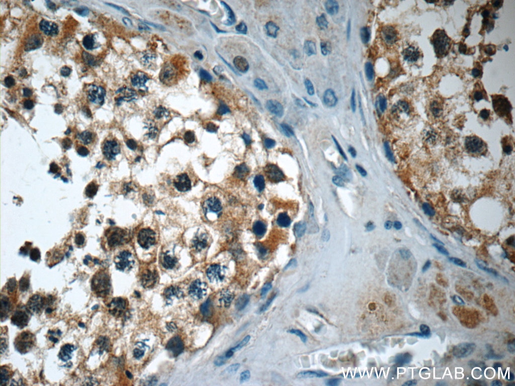 Immunohistochemistry (IHC) staining of human testis tissue using TEKT3 Polyclonal antibody (12959-1-AP)