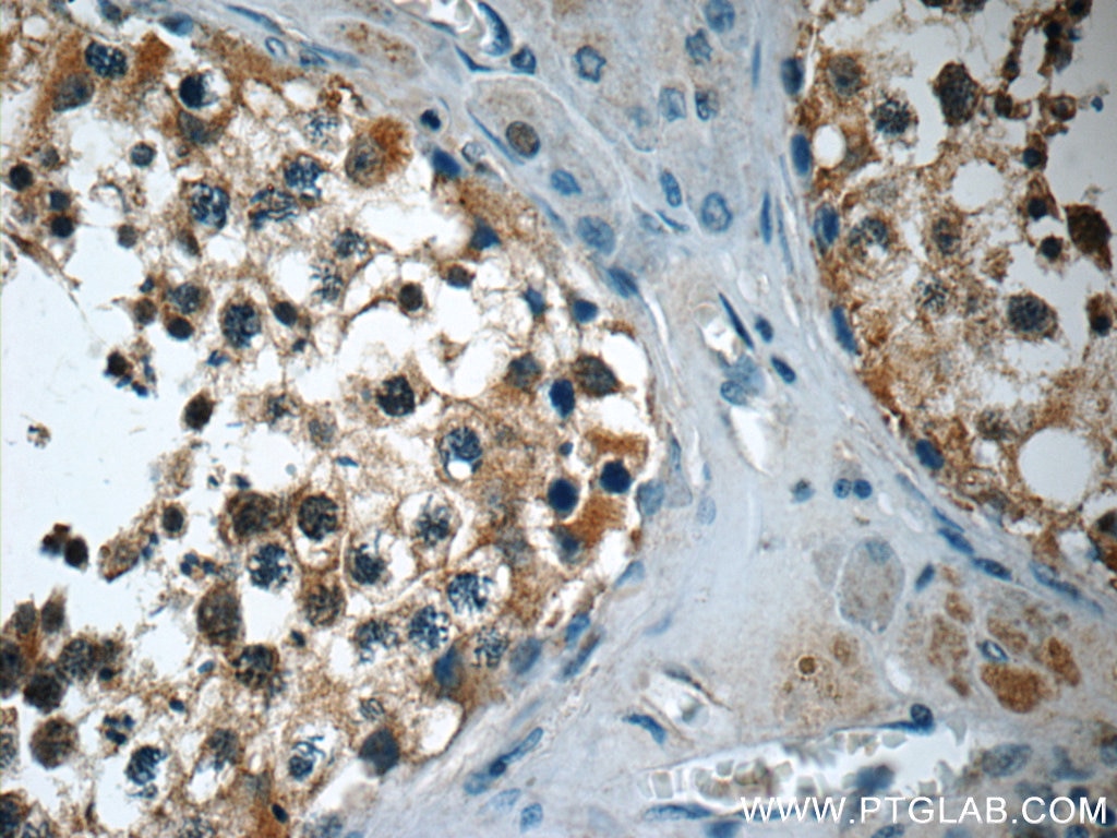 Immunohistochemistry (IHC) staining of human testis tissue using TEKT3 Polyclonal antibody (12959-1-AP)