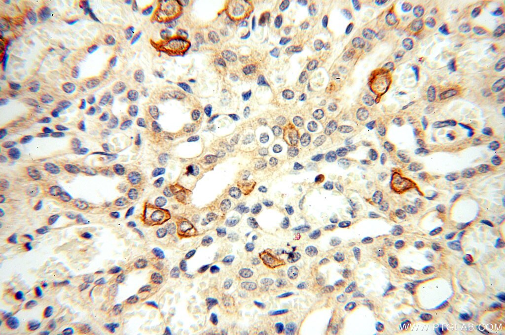 Immunohistochemistry (IHC) staining of human kidney tissue using TEKT4 Polyclonal antibody (17058-1-AP)